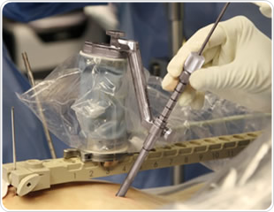 Article: Q&A with Dr. Doron Dinstein, VP Marketing, Mazor Robotics