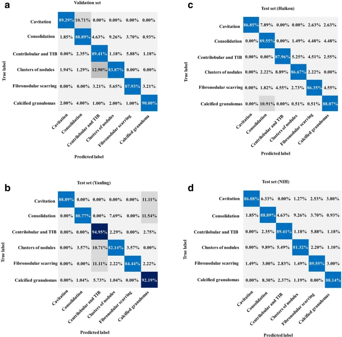Performance of the AI system for classification. (a) Normalized confusion matrices of multiclass critical imaging feature classification for the validation and test datasets. (b) Normalized confusion matrices of disease activity prediction for the test datasets. The shaded cells indicate the correct results obtained by the AI system.