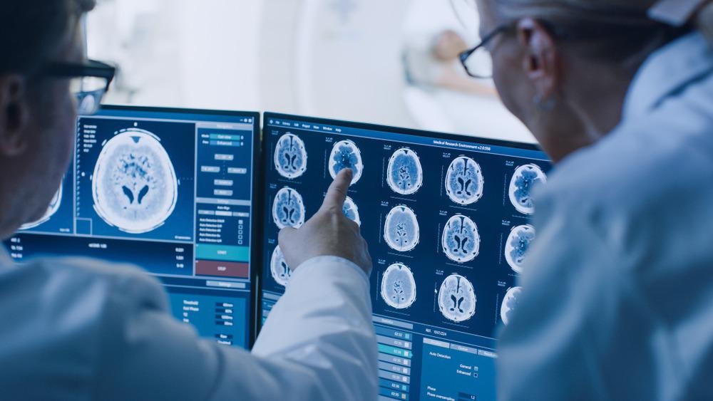 Accelerating Medical Diagnostics with AI