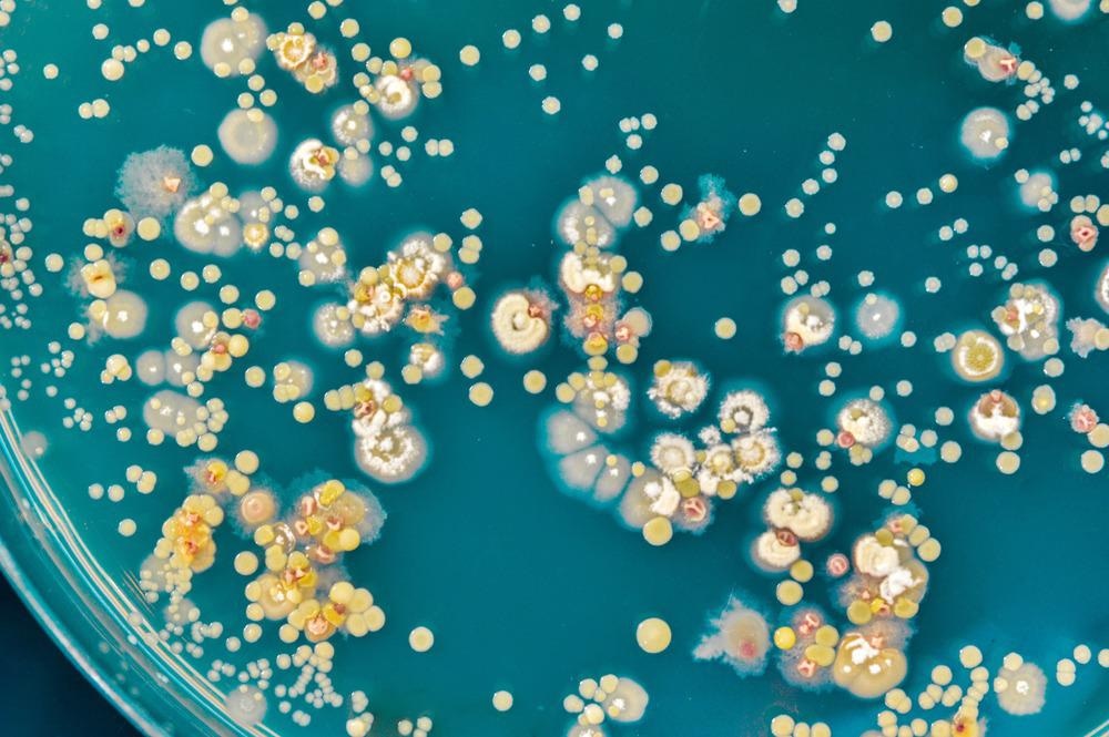 Implementing Collaborative Robots in a Microbiology Laboratory