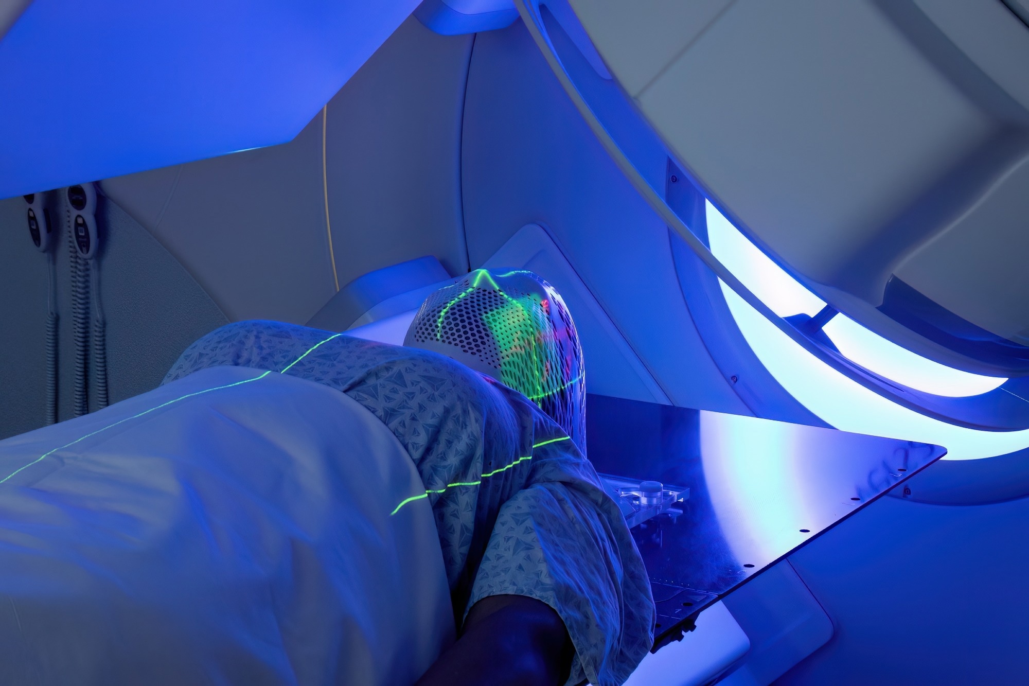 CyberKnife: A Breakthrough in Non-Invasive Cancer Treatment