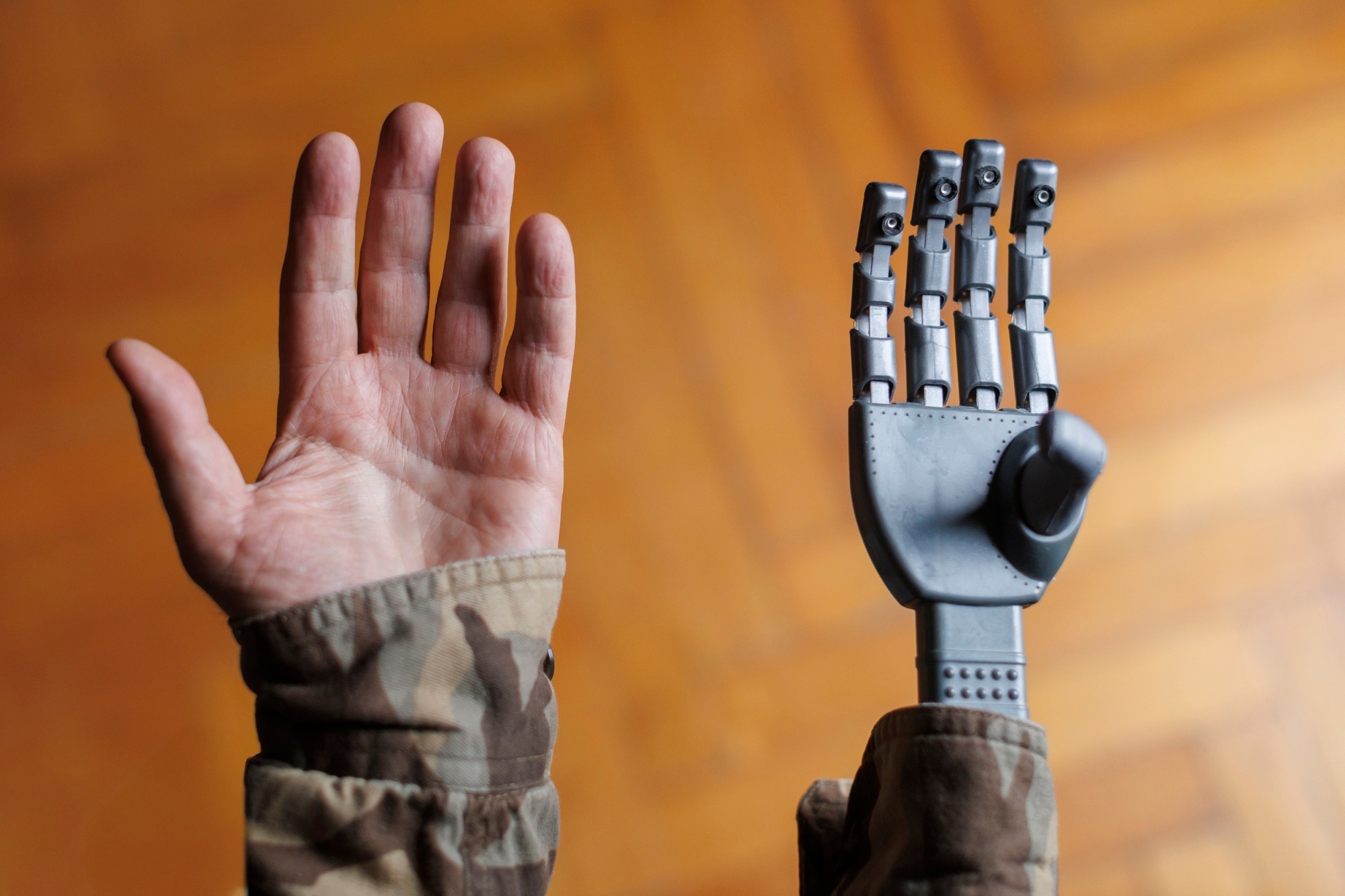Robotic Prosthetic Hands