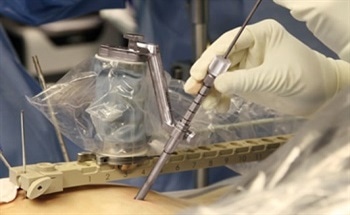 Applications and Benefits of Robots in Surgery Theatres: Dr. Doron Dinstein