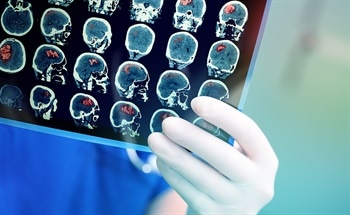 Next Generation Robots for Stroke Patients