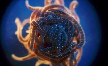 Assembling the Foundations of Soft Robot Systems with Worm Blobs