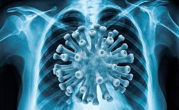 Artificial Intelligence Helps to Diagnose People with COVID-19