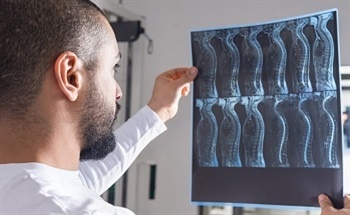 Automated Critical Care Systems for Spinal Cord Injury Sufferers