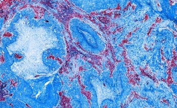 The Use of AI in Automating the Entire Imaging Pipeline
