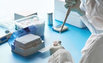 The Power of Lab Automation in Diagnostics