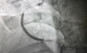An Introduction to Vascular Robotics