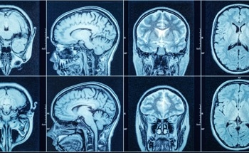 Can Neuroscience be Implemented into Robotics?