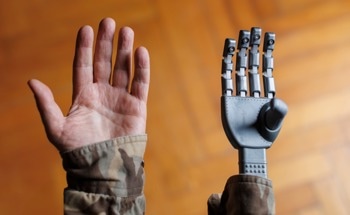 How Do Robotic Prosthetic Hands Work?