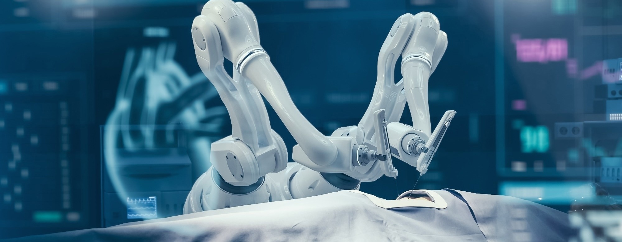 da Vinci Robotic Surgery: What It Is, Benefits & Risks