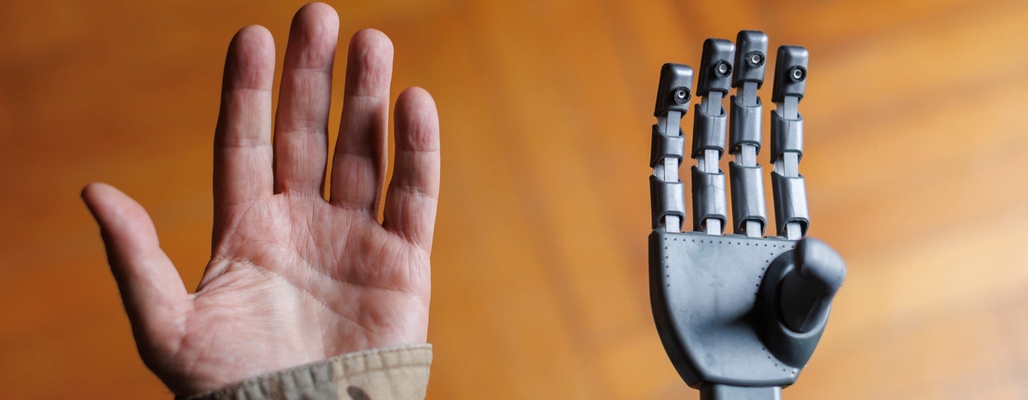 How Do Robotic Prosthetic Hands Work?