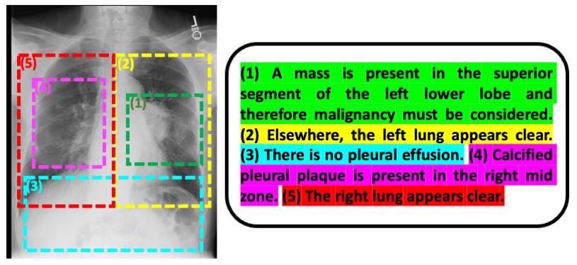 Researchers Improve Interpretive Abilities of AI by Using Radiology Reports.