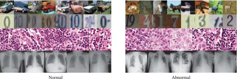 Training Neural Network to Detect Anomalies in Medical Images Using AI.