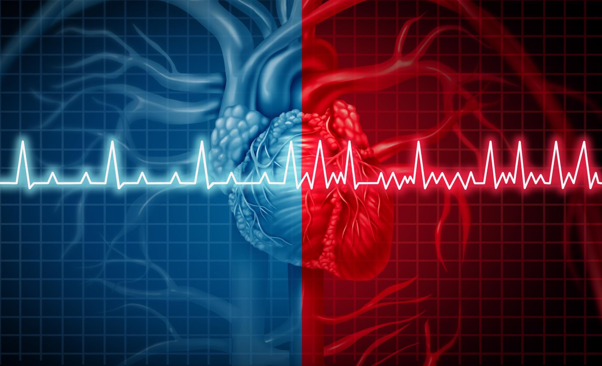 Novel AI-Based Technique can Predict Atrial Fibrillation Risk.
