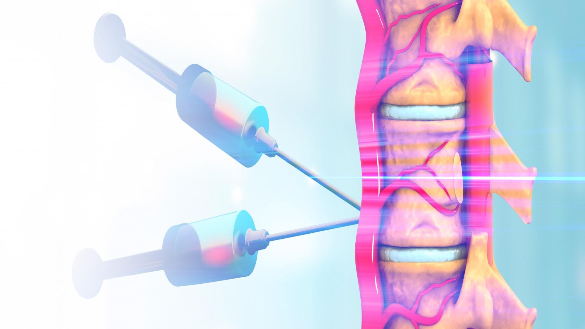 Researchers Stabilize ChABC to Degrade Scar Tissue and Promote Tissue Regeneration in SCI Patients.