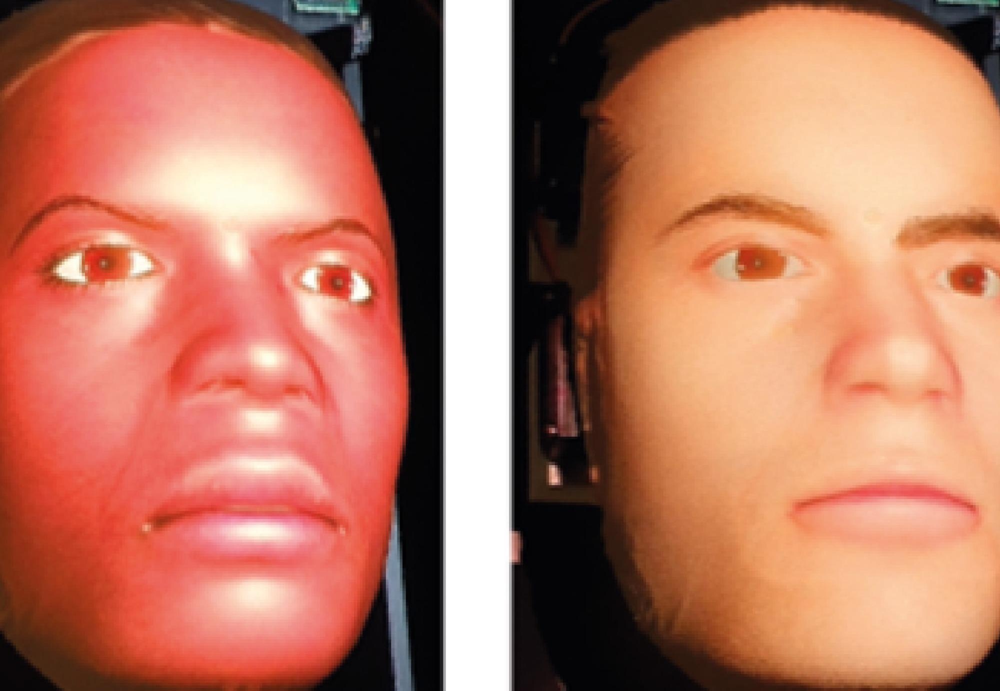 Producing Realistic Expressions of Pain on Robotic Patients.