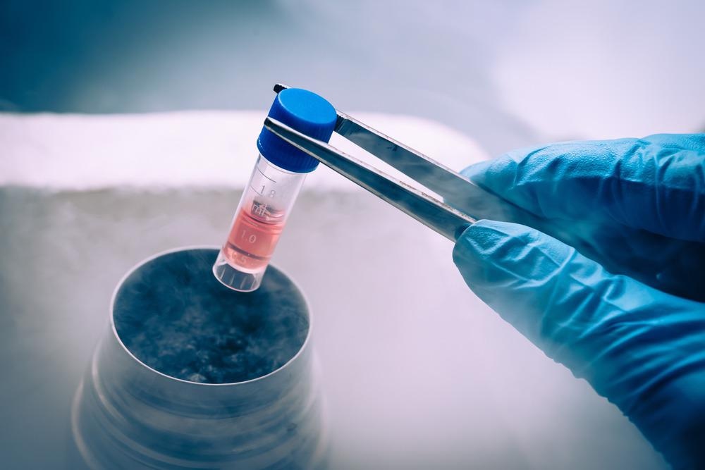 AI-Based Nanofountain Probe Electroporation Platform for Efficient Development of Stem Cells