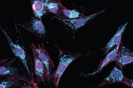 AI-Based Robotic Platform Unveils Unique Signatures of Parkinson’s Disease.