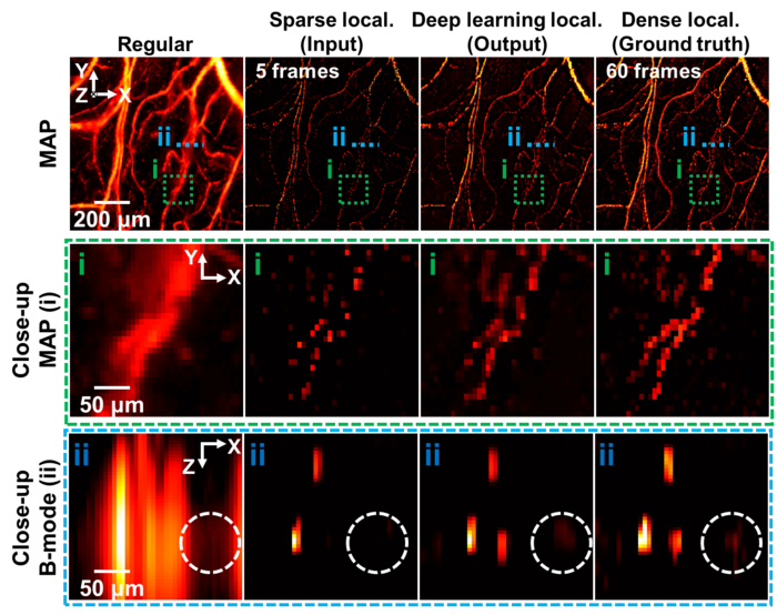 Researchers Employ Photoacoustic Imaging to Capture the Interiors of the Human Body.