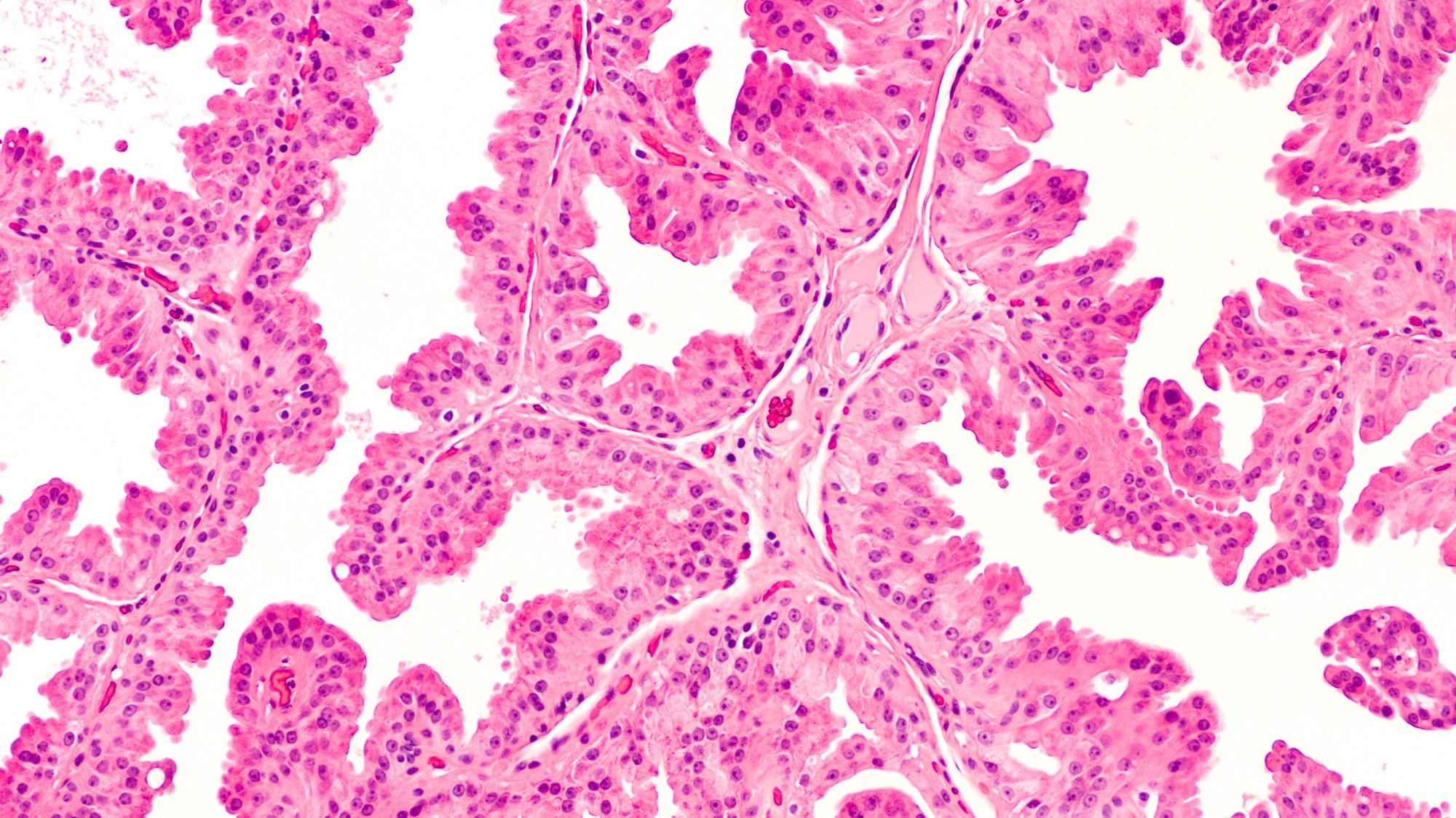 Researchers Create New AI-Based Techniques for Analyzing Digital Pathology Data.
