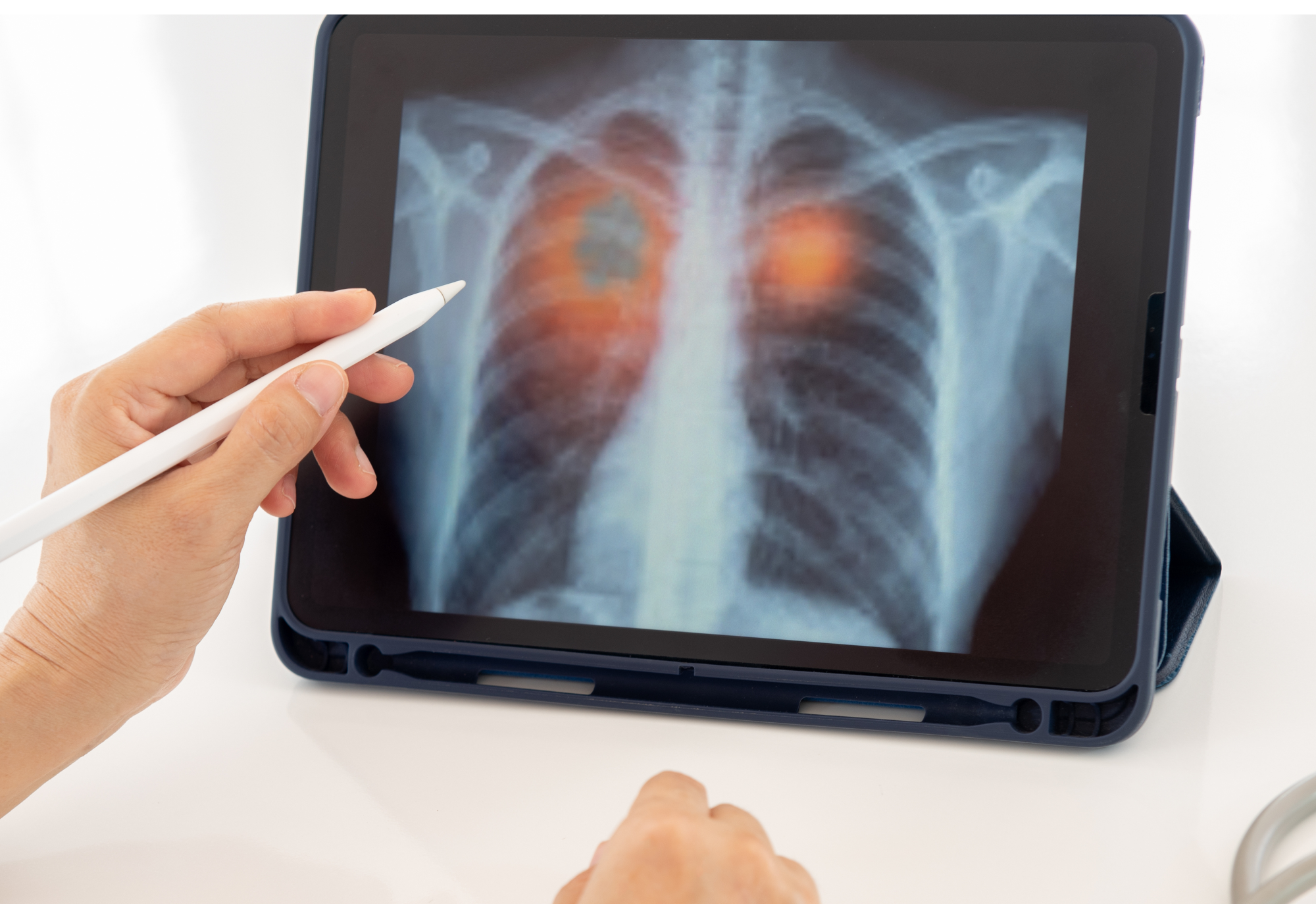 AI Could Be Used in Diagnosis of COVID-19 and Other Medical Complications.