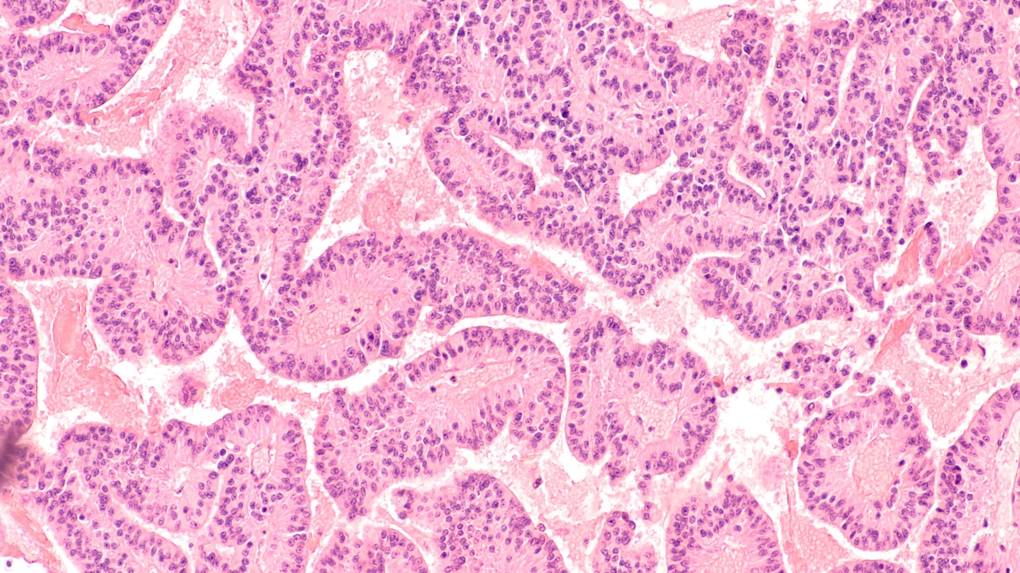 New AI Model Could Aid in the Diagnosis of Rare Diseases.