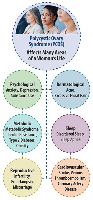 AI and ML to Detect and Diagnose PCOS Efficiently