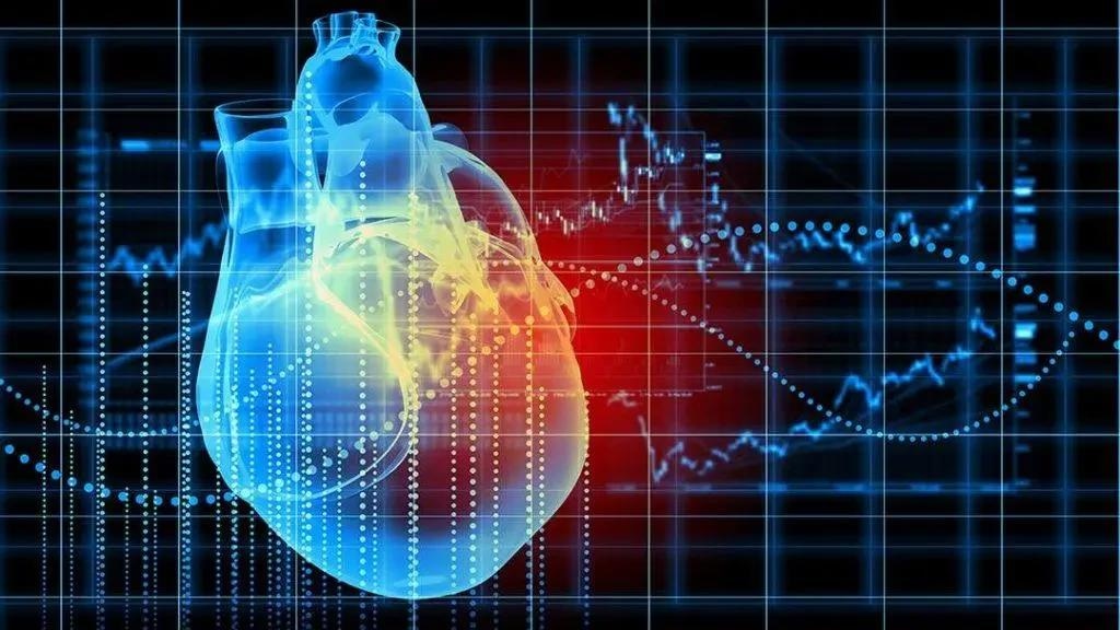 Early Recognition of Coronary Artery Disease Using Artificial Intelligence Electrocardiograms