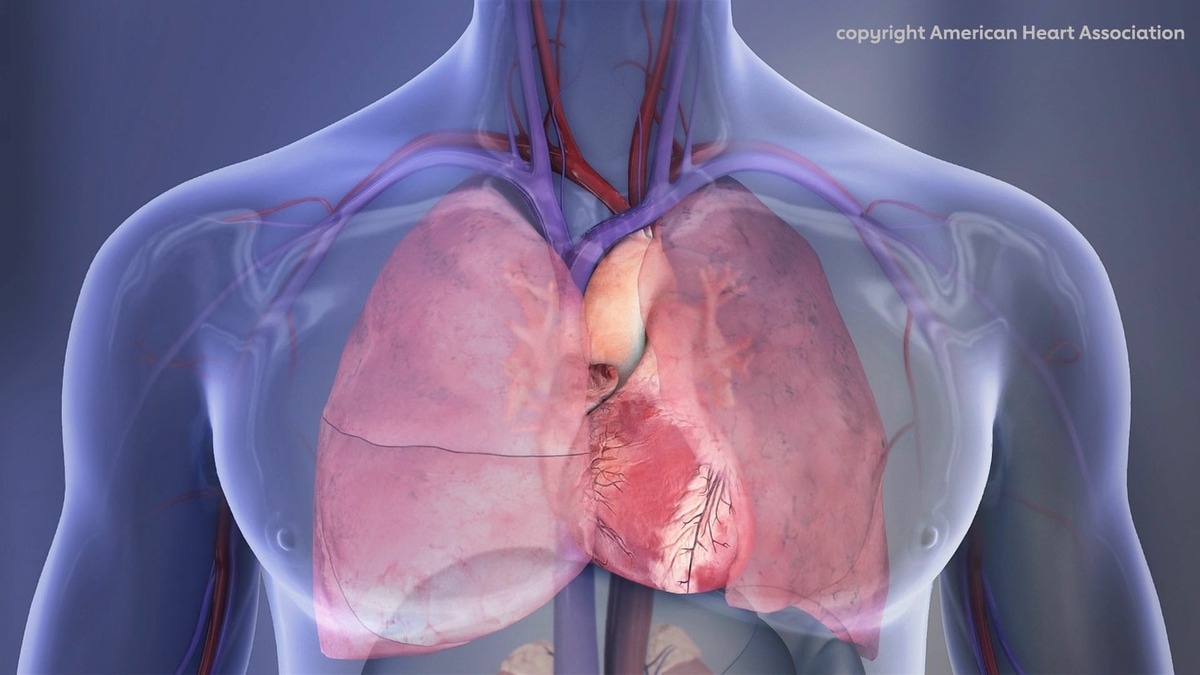 Predicting Sudden Cardiac Death Using Artificial Intelligence