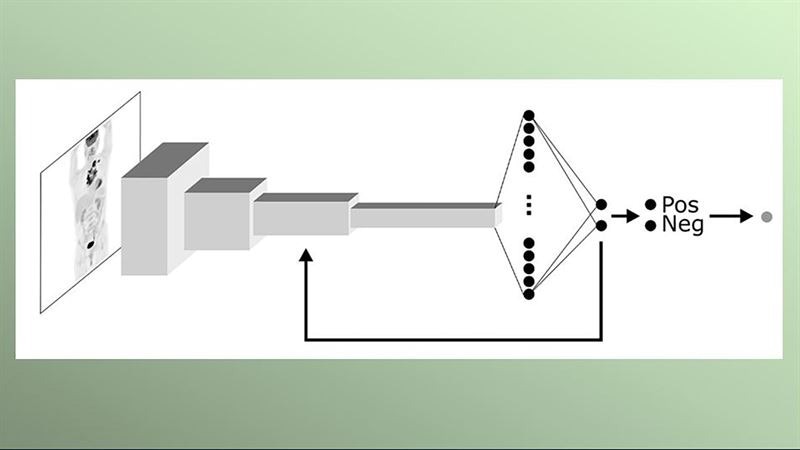 AI System Effectively Identifies Signs of Lymphoma in Scans