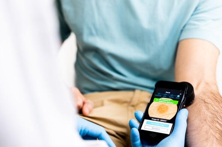 AI-Based Clinical Decision Support Tool for Cutaneous Melanoma Detection