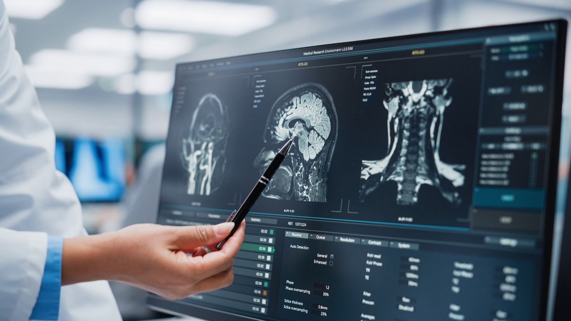 The Robotic Nerve