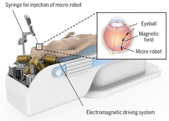 Novel Design Optimizes Electromagnetic System for Safer Eye Surgery