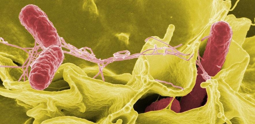 Machine Learning Reads Microscopy Images for Antibiotic Resistance