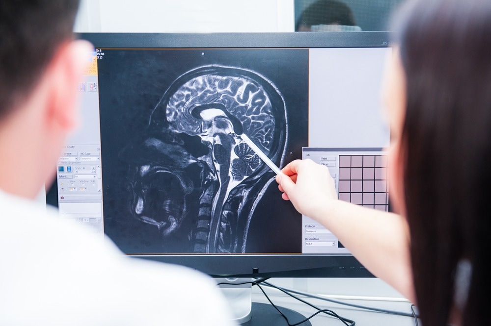 AI Tool Eliminates the Need for Unnecessary Dementia Tests
