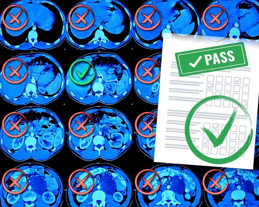 NIH Study Underscores Need for Further AI Development in Healthcare