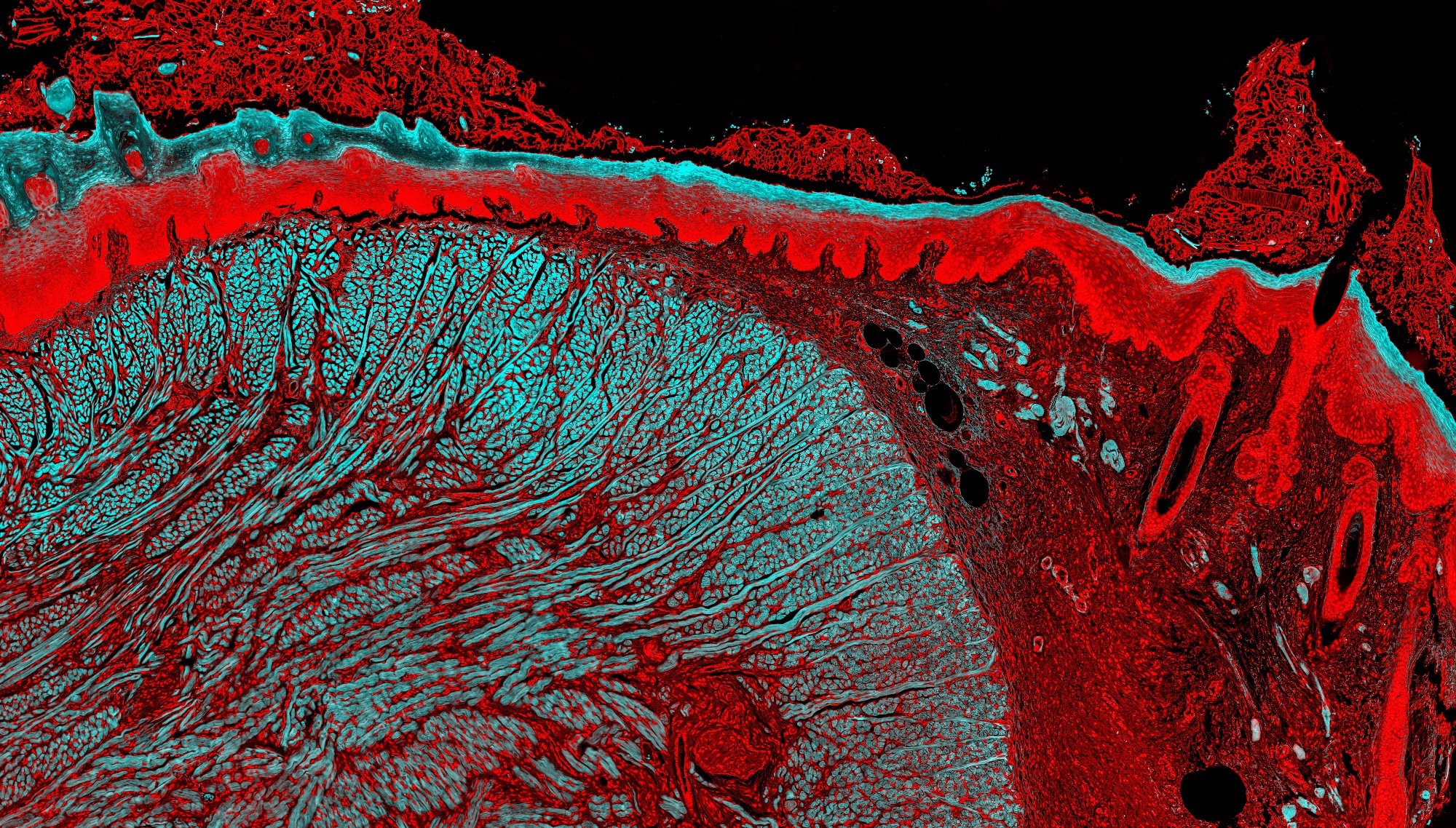 AI and Fluorescence Imaging Transform Cancer Surgery