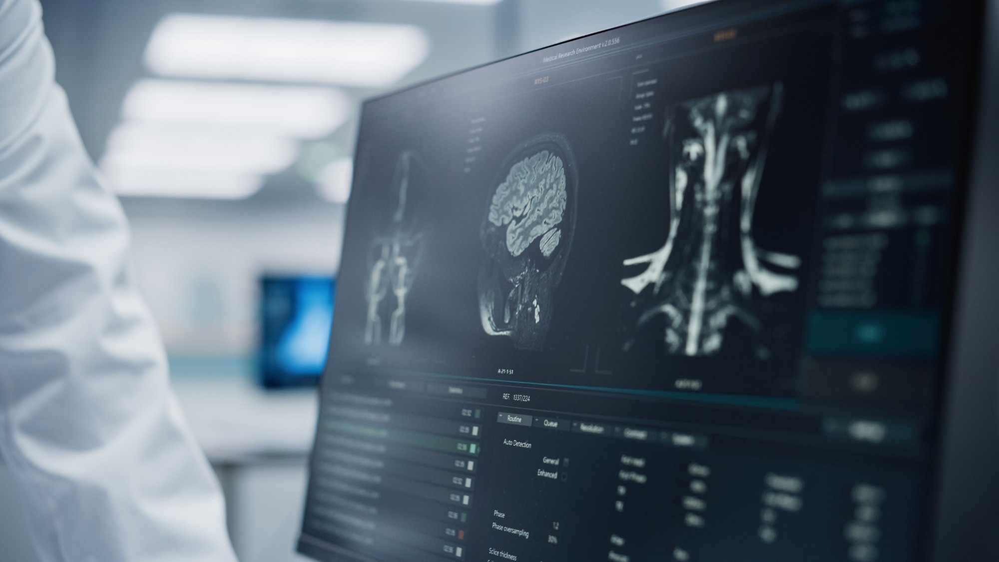 AI Tool ScribblePrompt Enhances Medical Imaging