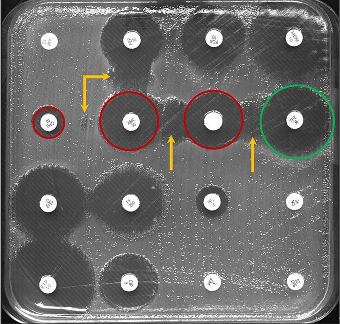 Kirby-Bauer disk diffusion test of gut bacteria