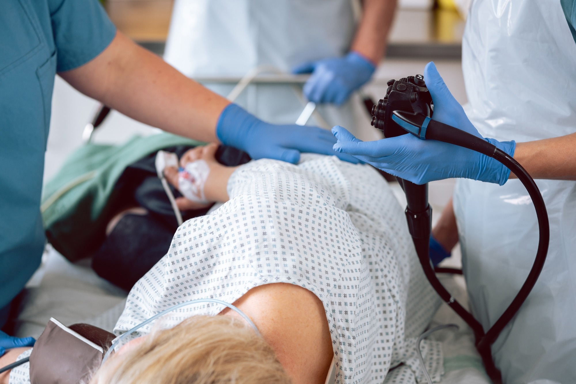 AI Advances Precision in Colorectal Cancer Screening