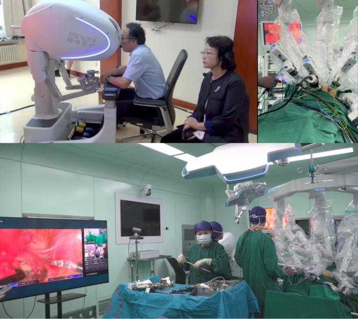 The surgical team and the Edge Multi-Port Endoscopic Surgical Robot MP1000 (Edge MP1000) surgical system. Image Credit: Wei Zhang