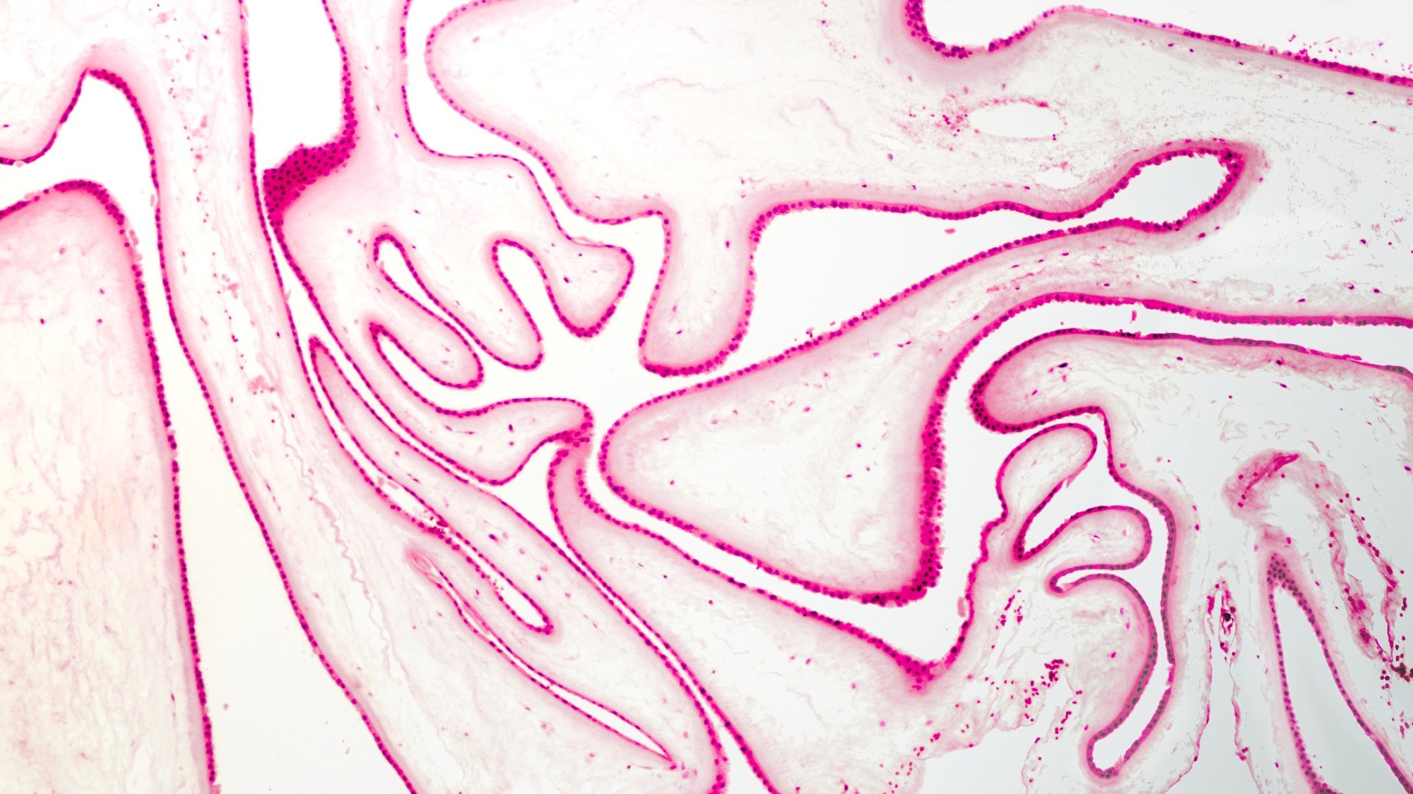 A cross section of human placental membranes, with an unusual folding pattern.