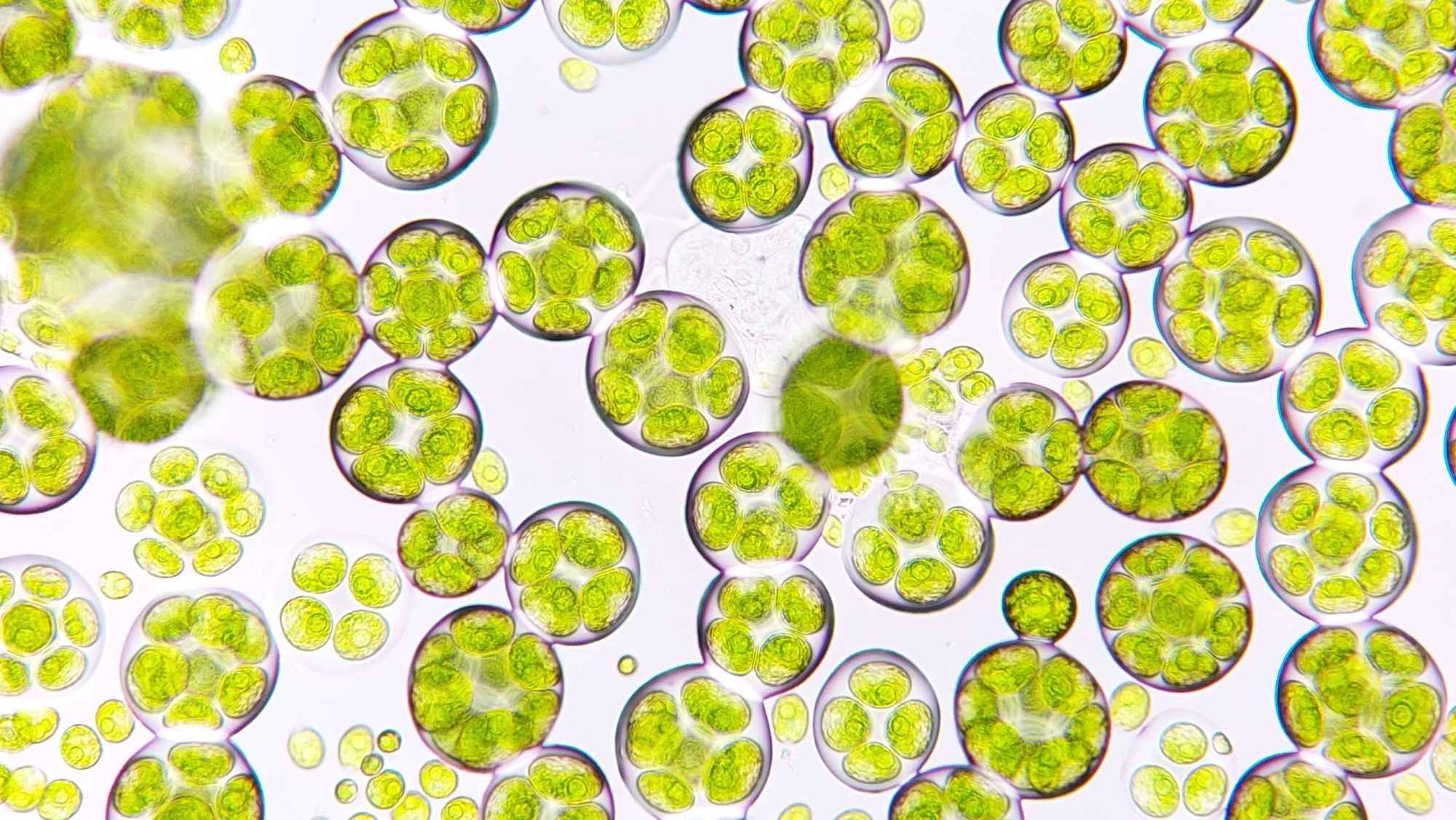Freshwater microalgae blooming under microscope.
