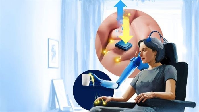 Most Advanced Artificial Touch for Brain-Controlled Bionic Hand