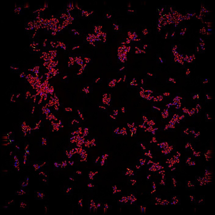 A fluorescence microscopy image reveals the tuberculosis-causing bacterium Mycobacterium