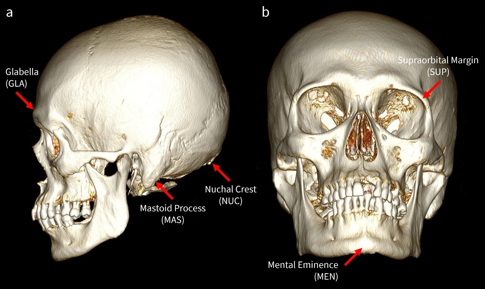 estimation of biological sex in humans, skulls, artificial intelligence