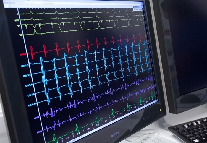 algorithm for heart treatment and diagnosis